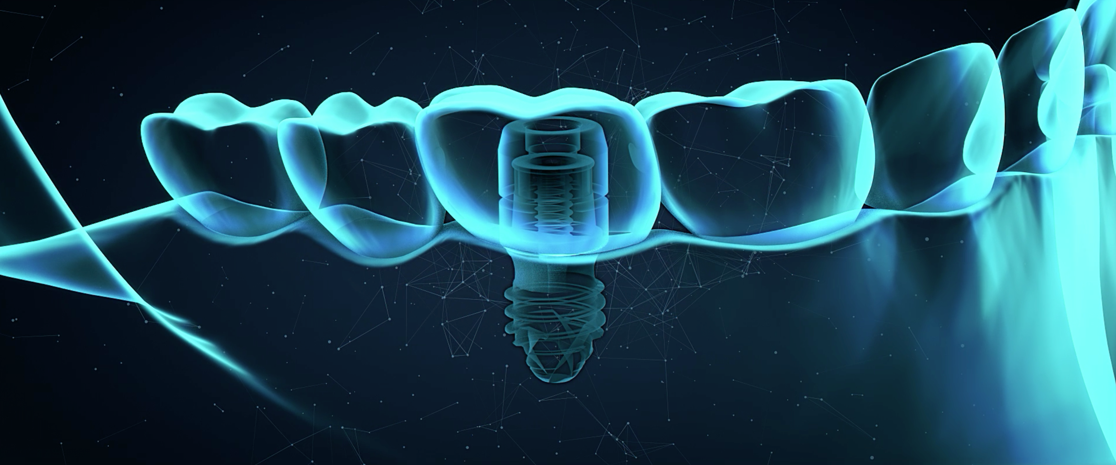 B1ONE + IDICAM + ALFRED: gli alleati perfetti