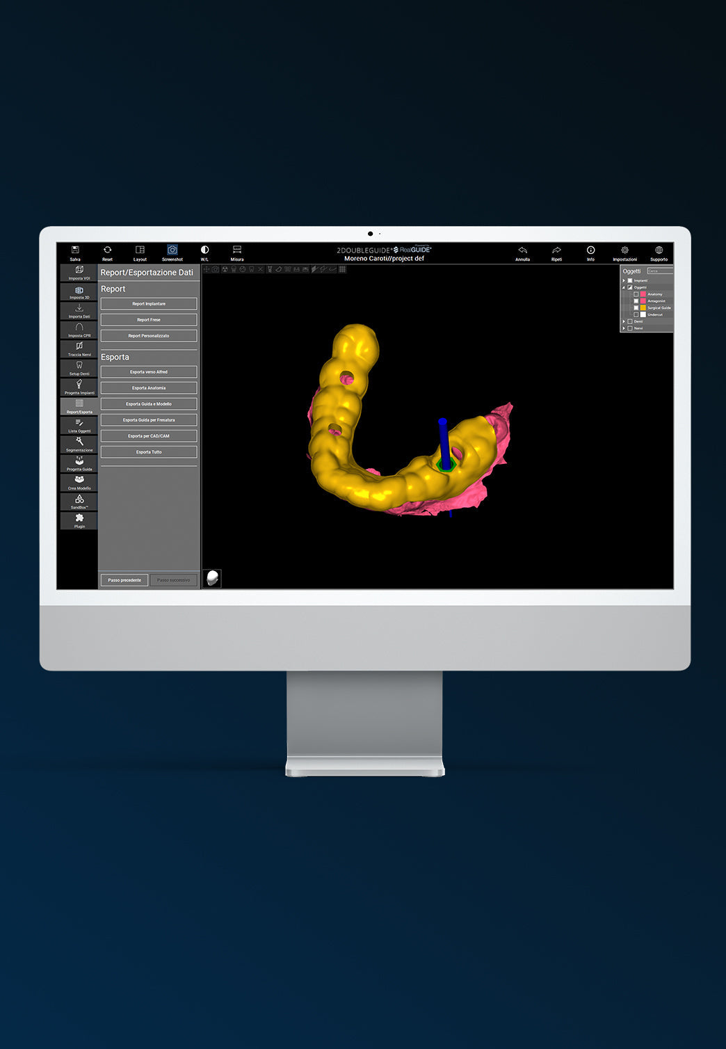I Vantaggi della Chirurgia Guidata