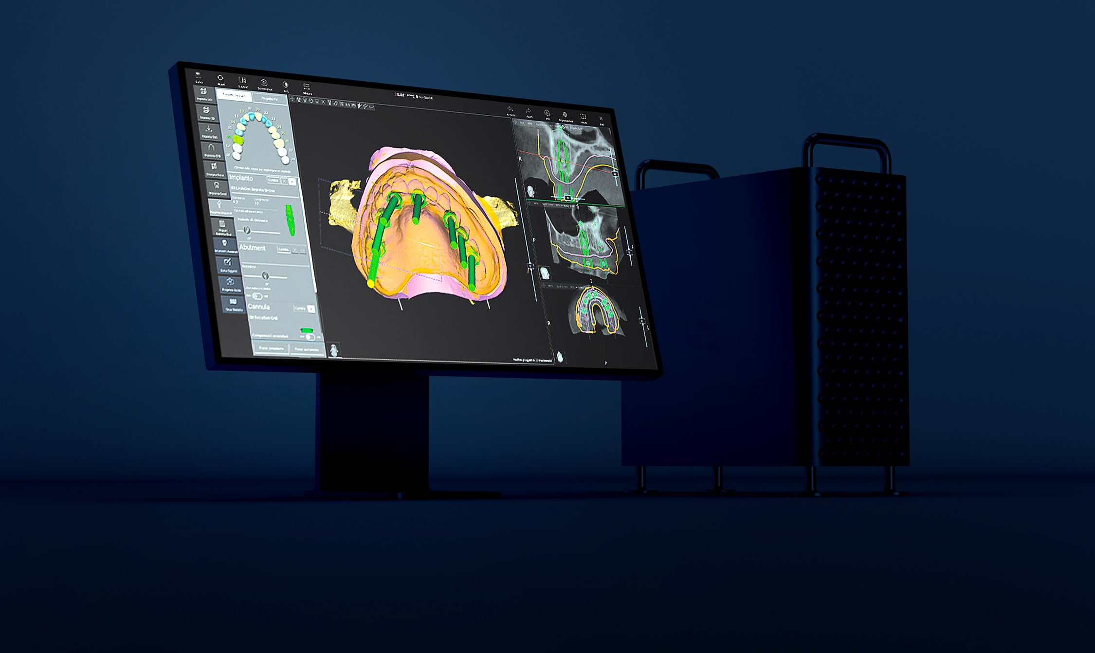 software 2doubleguide per chirurgia guidata