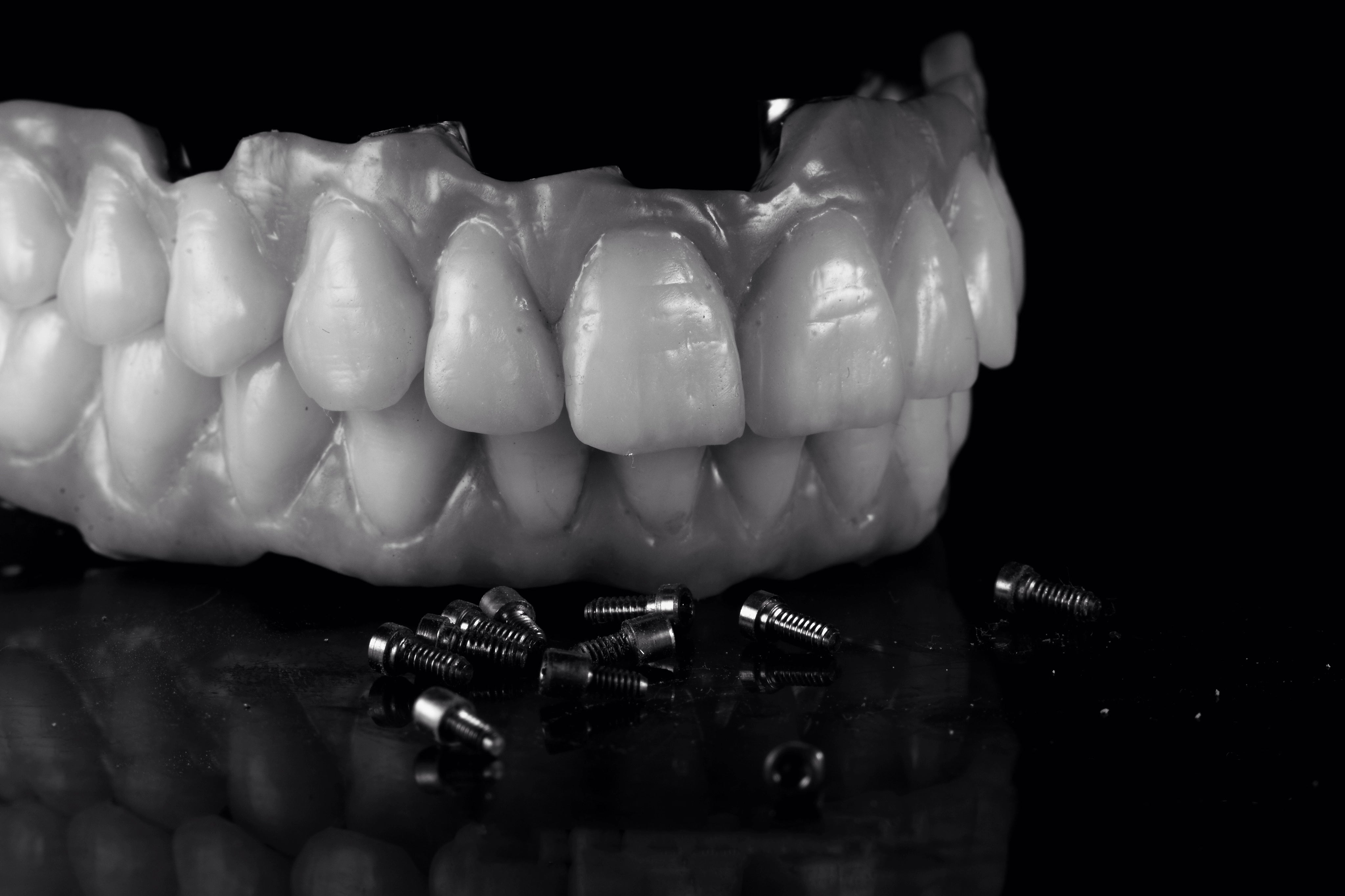 lavorazione denti idi rdl