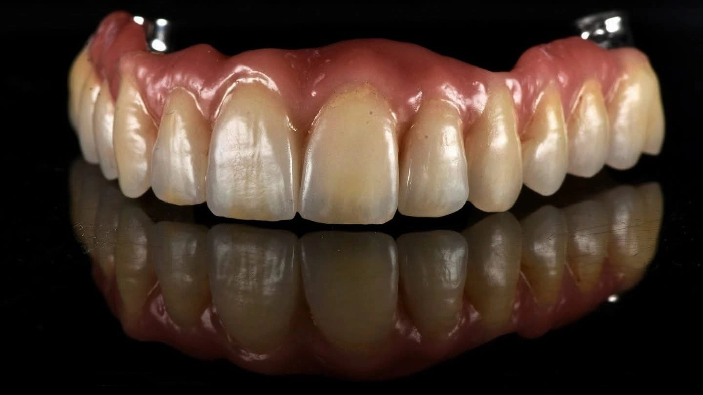 lavorazione denti idi rdl