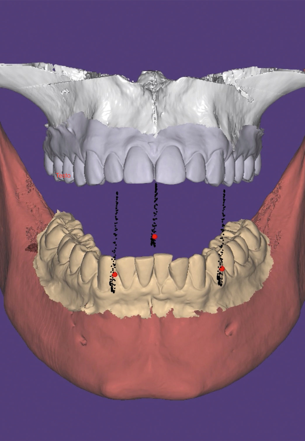 previsualizzazione e diagnosi