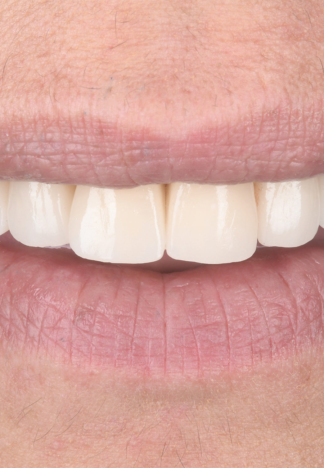 colorazioni perfette grazie rayface scanner facciale by ray