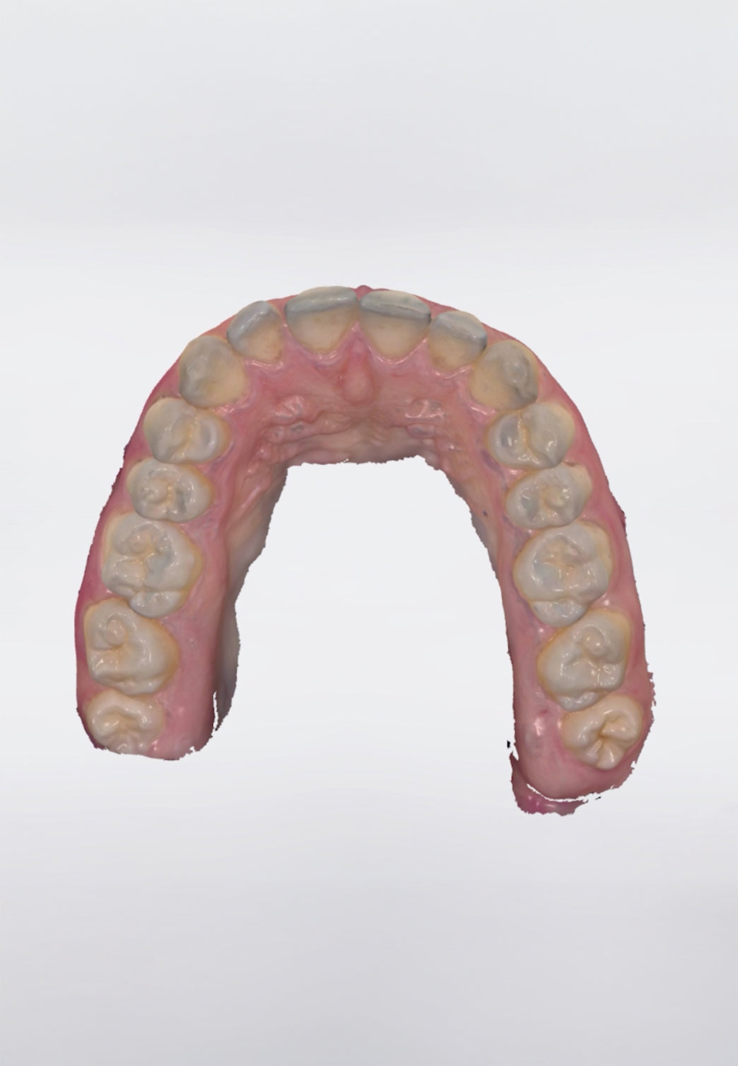 trios 3Shape scanner intra-orale