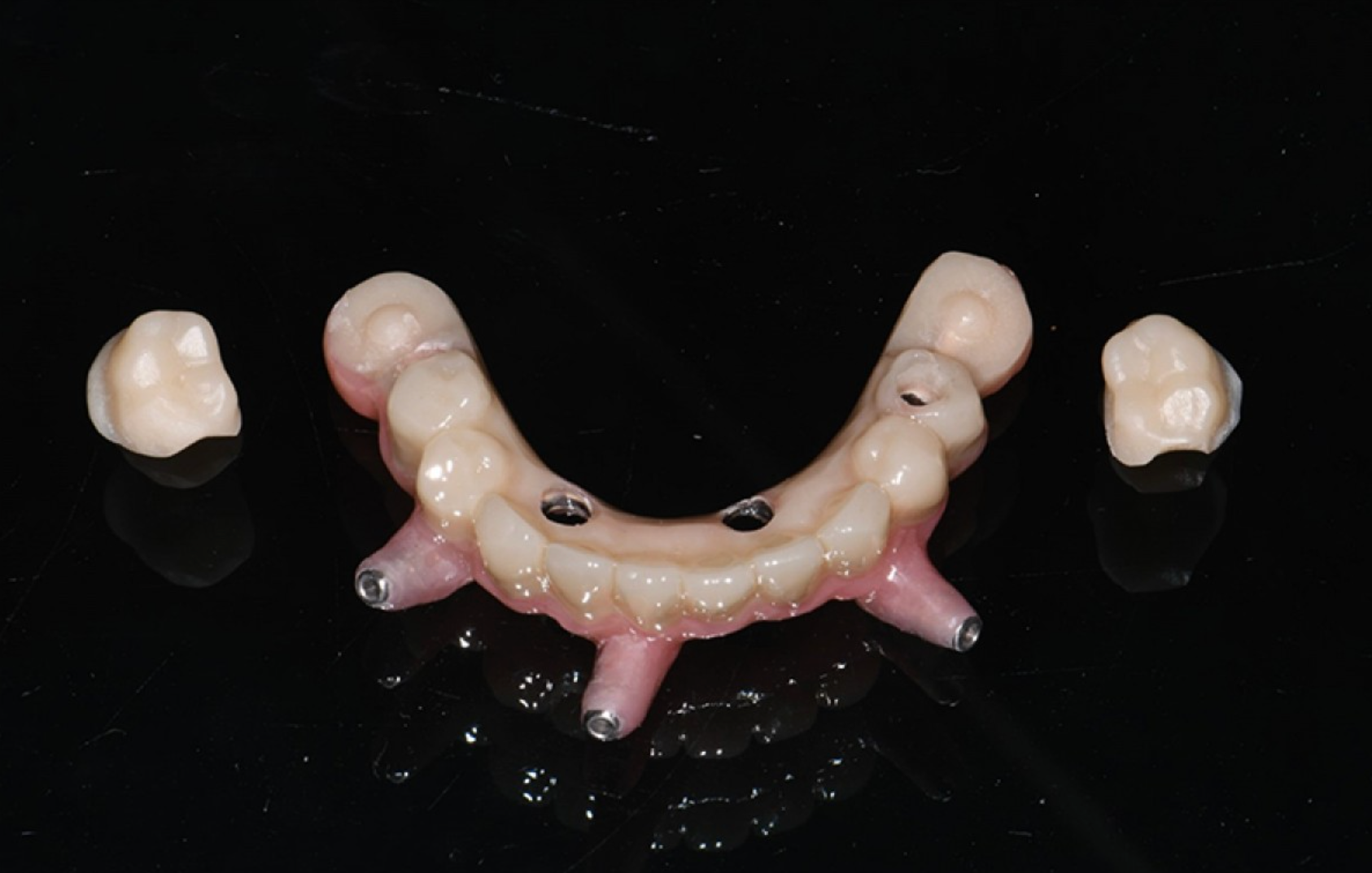 IL CARICO IMMEDIATO CON DOUBLEGUIDE, B1ONE e BLACKBOX