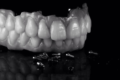 lavorazione denti idi rdl