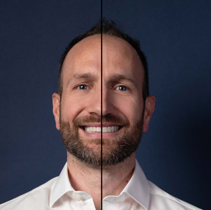 Invisalign® ART