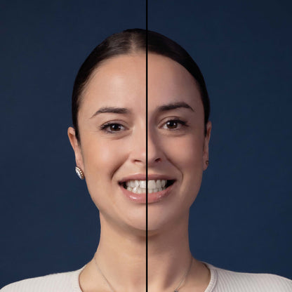 Invisalign® ART
