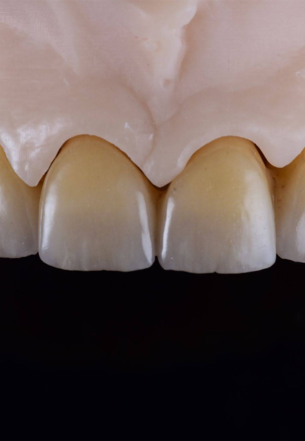 colorazione denti