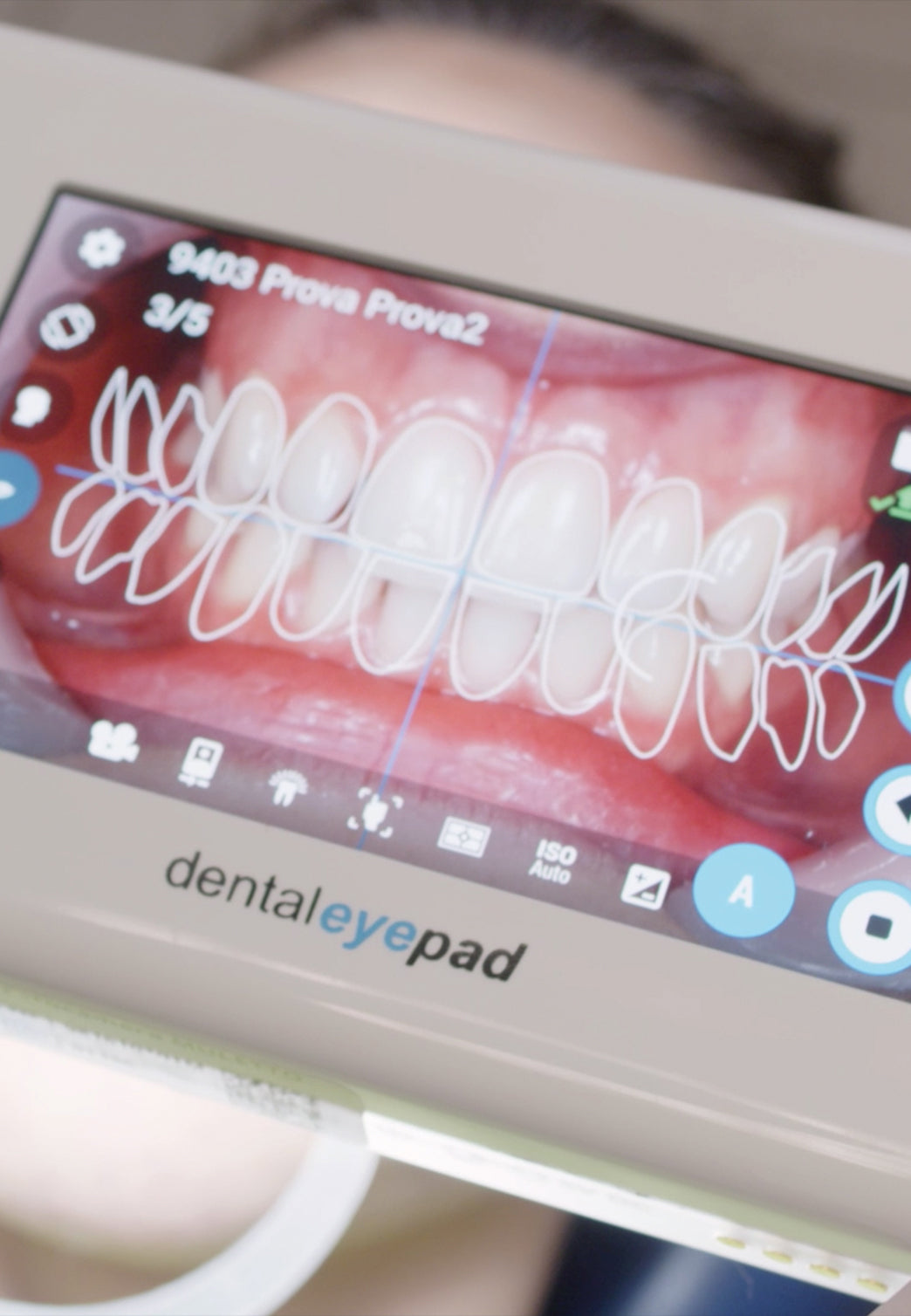 dentaleyepad zoom